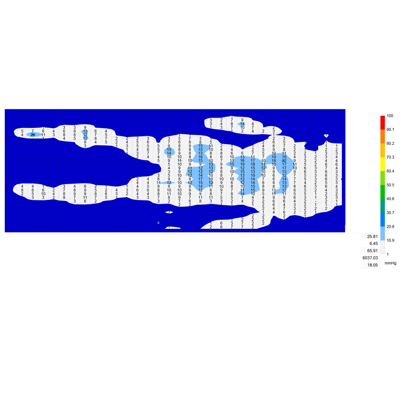 /globalassets/0-international/about-us/news-and-social-media/news/2022/pressure-mapping-image_news.jpg?width=1280&Quality=90&rmode=max&scale=down