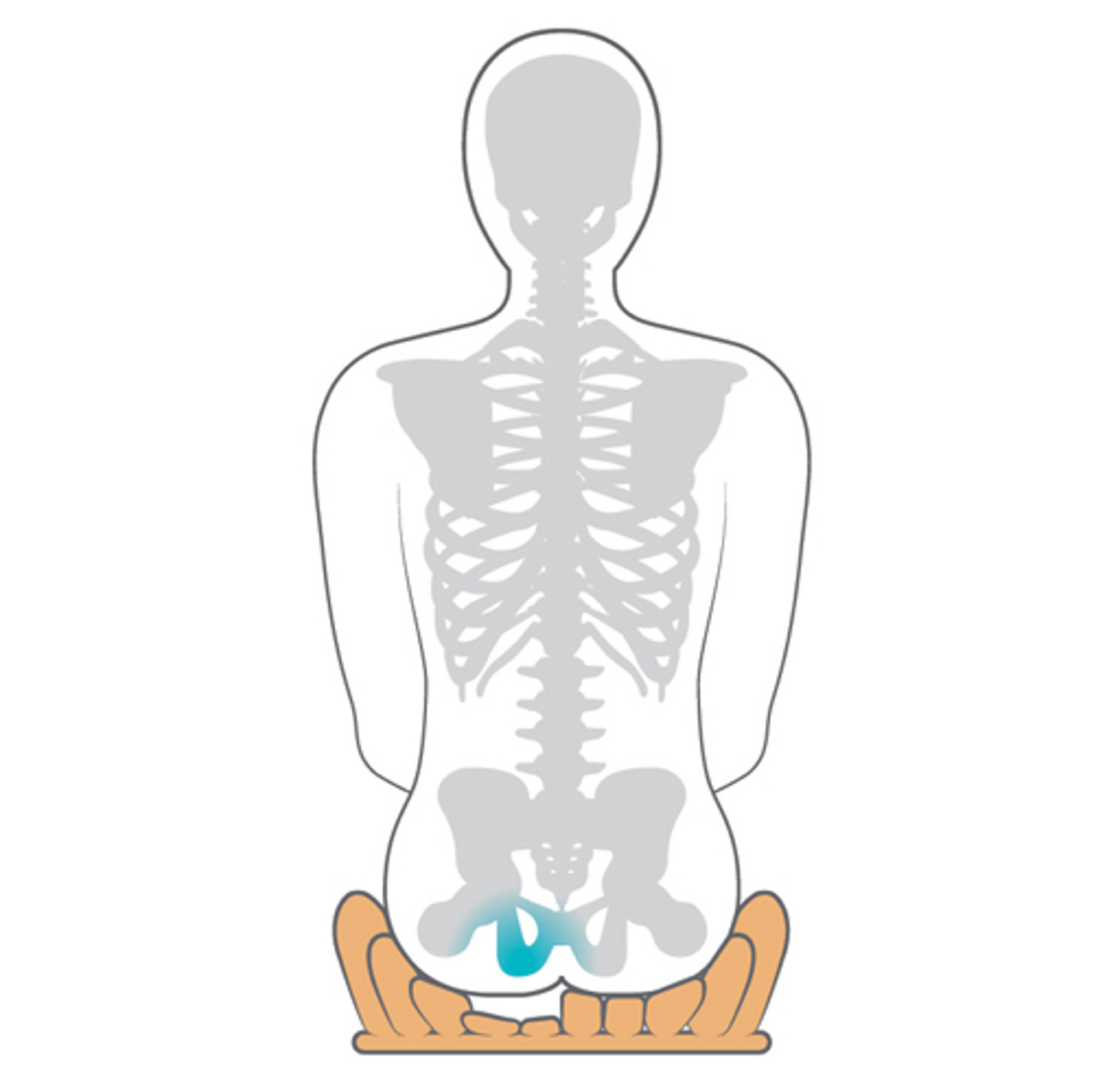 /globalassets/0-international/knowledge/knowledge/cases/mwc-and-pressure-care/star_illustration-03_500x500.jpg?width=1280&Quality=90&rmode=max&scale=down