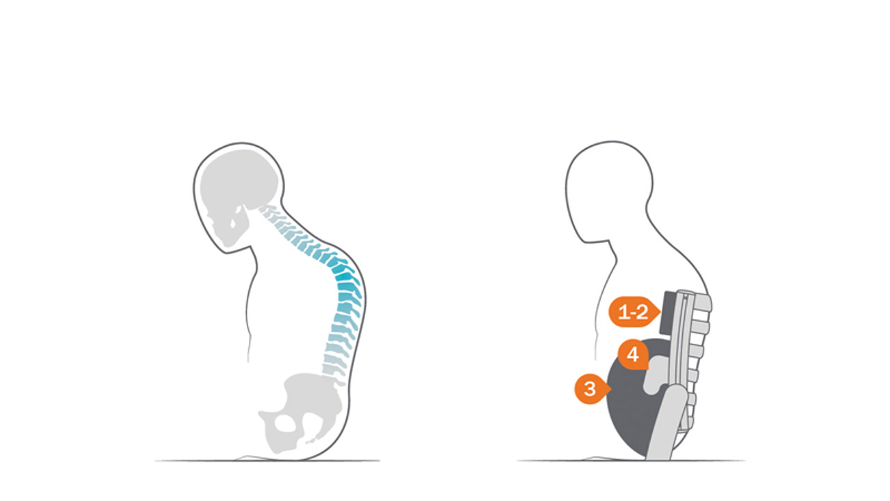 /globalassets/0-international/wheelchairs-and-pressure-care-landing-page/body-shapes-cross-5-and-6-and-prio-3a/cross-5-and-6/page---kyphopsis/illustration_cross_accessories_body-shape-kyphosis.jpg?width=1280&Quality=90&rmode=max&scale=down