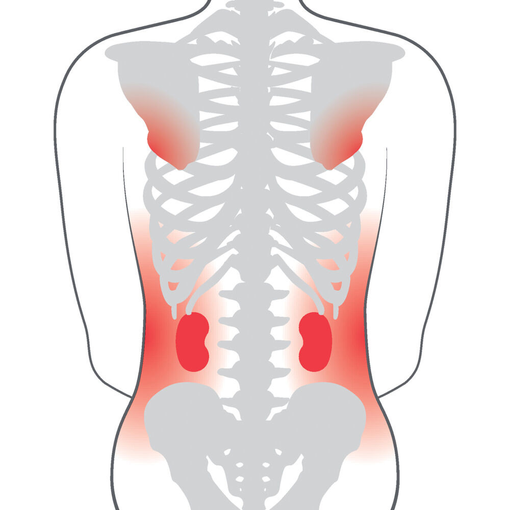The Cross 3A back support offers adjustments for a supportive well balanced back support. It is covered by a resilient high density foam cover which evens outs the pressure. No peak pressure on sensitive zones – an important condition for improving the user´s sitting tolerance over time.