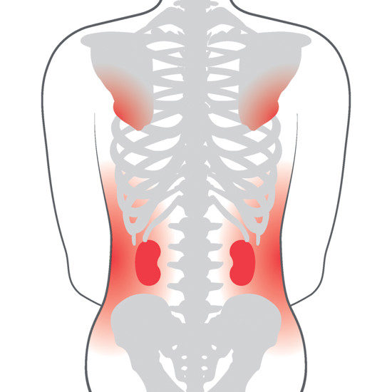 Etac 3A back support