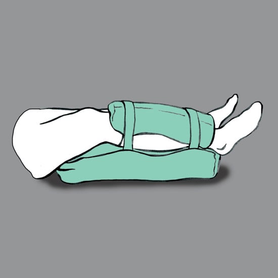 Rhombo-fill® leggmansjett