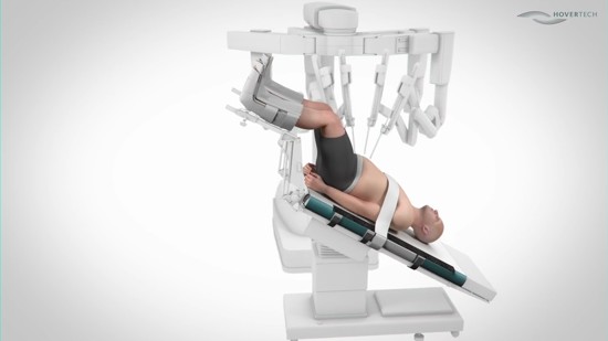Get an introduction to the HoverMatt T-Burg and see how it supports efficient Trendelenburg positioning and air-assisted transfers in the operating room.